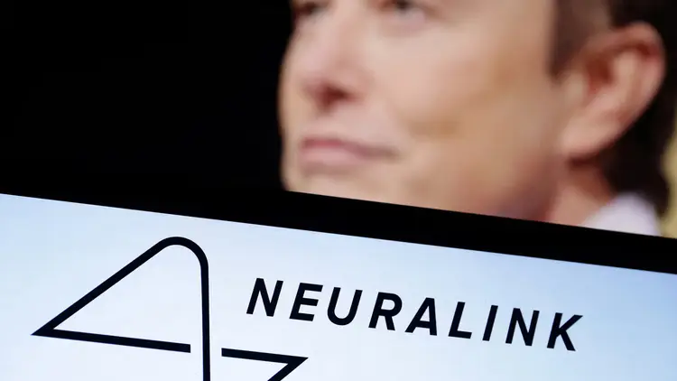 Elon Musk Siap Produksi Massal Chip Otak Neuralink