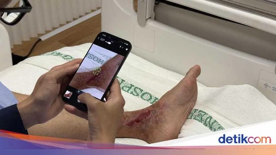 Gadget Apple Tingkatkan Kualitas Layanan Kesehatan di Singapura