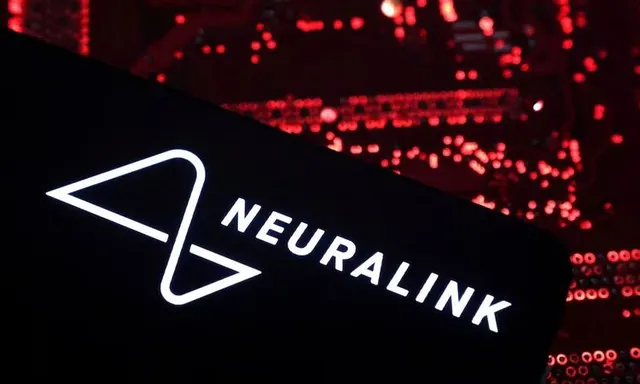 Elon Musk Percepat Integrasi Otak dan Mesin, Neuralink Siap Produksi Implan Otak 2026