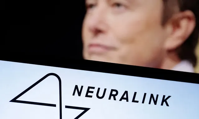 Elon Musk Siap Produksi Massal Chip Otak Neuralink